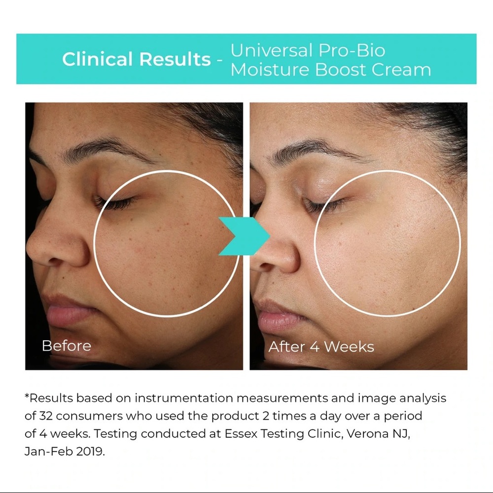 Universal Pro-Bio Moisture Boost Cream - Picture 5 of 5